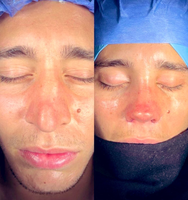 Fenerbahçeli Emre Mor estetik yaptırdı! Taraftarlardan büyük tepki!