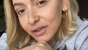 Hadise'nin makyajsız hali