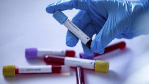 ABD'de İlginç Anket!