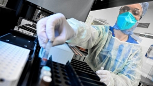 Türkiye koronavirüs kaynaklı ölümde kaçıncı sırada?