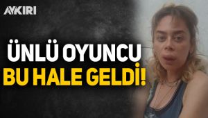 Ünlü oyuncu bu hale geldi!