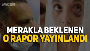 Ozan Güven ve Deniz Bulutsuz'un Adli Tıp raporu yayınlandı