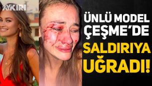 Dünyaca ünlü model Daria Kyryliuk Çeşme'de darp edildi