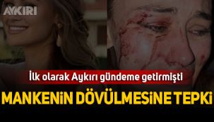 Ömer Çelik'ten darp edilen Ukraynalı modelle ilgili açıklama