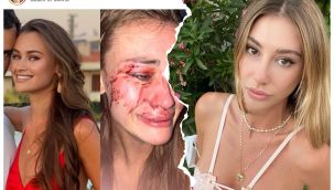 Yakın arkadaşı Çeşme'de darp edildi 