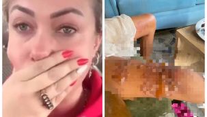 Yeliz Yeşilmen'in kızı kaynar su ile yandı!