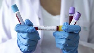 Yeni tip corona virüs tehlikesi: SADS-CoV