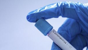 Karabük'te günlük 250 koronavirüs hastası çıkıyor: Sadece belediyede 50 çalışan yakalandı!