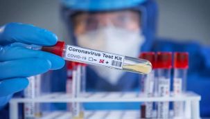 Türkiye'de son 24 saatte 168 can kaybı, 7.550 yeni vaka tespit edildi