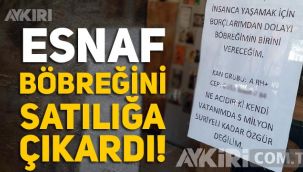 Borçları yüzünden böbreğini satışa çıkaran işletmeci, dükkanının camına ilan astı