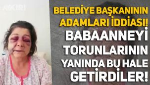 Belediye Başkanının adamları iddiası: Giresun'da babaanneyi torunlarının yanında bu hale getirdiler!