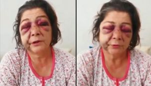 Giresun'da Ülfet Dikici'nin darp edilmesi hakkında CHP'den açıklama!