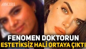 Berika Demir'in estetiksiz hali ortaya çıktı! Berika Demir kimdir