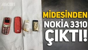 Kosova'da erkek hastanın midesinden Nokia 3310 çıkarıldı!