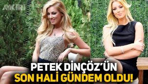 Şarkıcı Petek Dinçöz'ün son hali gündem oldu