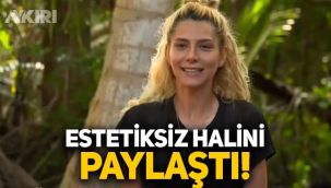 Survivor İlayda Şeker estetiksiz halini paylaştı!