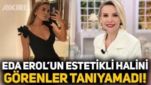 Esra Erol'un kardeşi Eda Erol'un estetikli halini görenler tanıyamadı! İşte Eda Erol'un son hali...