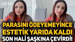 Parasını ödeyemeyince estetik ameliyatı yarıda kaldı, son hali şaşkına çevirdi