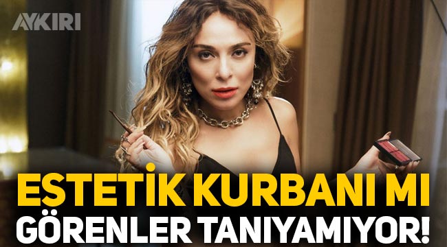 Ziynet Sali'yi görenler tanıyamıyor! Son hali dikkat çeken Ziynet Sali estetik mi yaptırdı