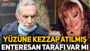 Aydemir Akbaş'tan Bergen sözleri: Yüzüne kezzap atılmış, enteresan tarafı var mı?