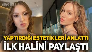 Duygu Özaslan yaptırdığı estetikleri tek tek anlattı, ilk halini paylaştı