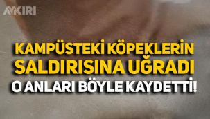 Kocaeli Üniversitesi kampüsünde köpeklerin saldırısına uğrayan üniversite öğrencisi o anları böyle kaydetti