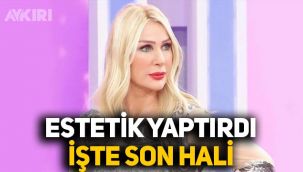 Çağlar Ökten'le evlilik hazırlığı yapan Seda Sayan estetik yaptırdı