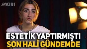 Estetik yaptıran Mika Raun'un son hali dikkat çekti