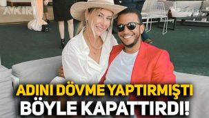 Mısırlı sevgilisinin adını dövme yaptırmıştı: Şeyma Subaşı böyle kapattırdı