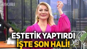 Songül Karlı estetik yaptırdı, yüzünü gerdirdi: İşte son hali