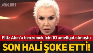 Filiz Akın'a benzemek için 10 ameliyat olan Seyhan Soylu'nun son hali şaşırttı!