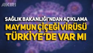 Maymun çiçeği virüsü Türkiye'de var mı? Sağlık Bakanlığı'ndan açıklama yapıldı