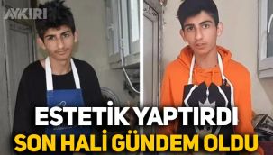 Yemek videolarıyla ünlenmişti: Taha Duymaz estetik yaptırdı, son hali gündem oldu