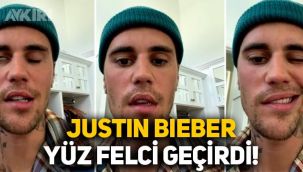 Dünyaca ünlü şarkıcı Justin Bieber yüz felci geçirdi, son hali gündem oldu