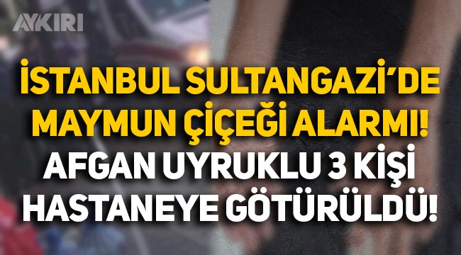 İstanbul Sultangazi'de maymun çiçeği alarmı: Afgan uyruklu üç kişinin test sonucu belli oldu