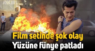 İsmail Hacıoğlu ölümden döndü, film setinde yüzüne fünye patladı