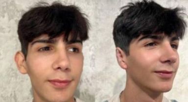 Taha Duymaz, kulaklarını da yaptırdı: Son halini sosyal medyadan paylaştı