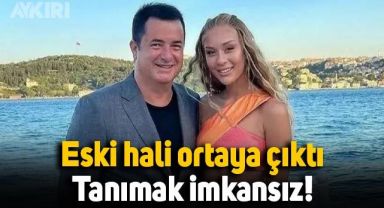 Acun Ilıcalı'nın sevgilisi Çağla Altunkaya'nın eski hali ortaya çıktı, tanımak imkansız!