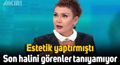 Estetik yaptıran Serap Paköz'ü görenler tanıyamıyor: Son hali dikkat çekti