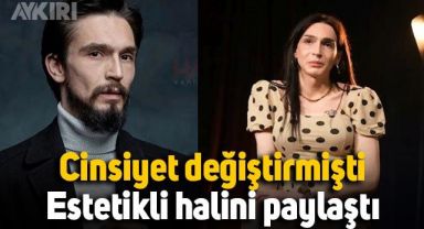 Cinsiyet değiştiren oyuncu Ahmet Melih Yılmaz, göğüs estetiği yaptırdı