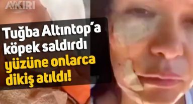 Tuğba Altıntop'un son durumu nasıl? Yüzünde iz kalabilir