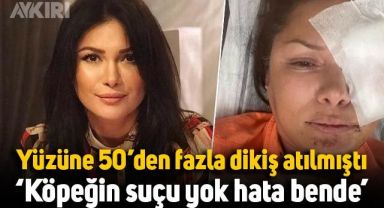 Yüzüne 50'den fazla dikiş atılan Tuğba Altıntop: