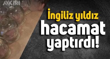 İngiliz yıldız Jack Grealish hacamat yaptırdı