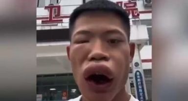 Video beğenisi alamadığını ifade eden fenomen, canlı yaban arısı yemeye çalıştı