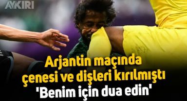 Arjantin - Arabistan maçında çenesi ve dişleri kırılmıştı: 'Benim için dua edin'