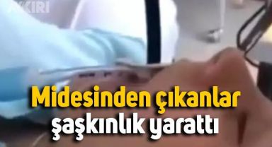 Endoskopiye alınan hastanın midesinden çıkanlar şaşkınlık yarattı