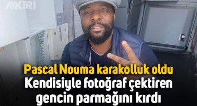Pascal Nouma karakolluk oldu: Kendisiyle fotoğraf çektiren gencin parmağını kırdı