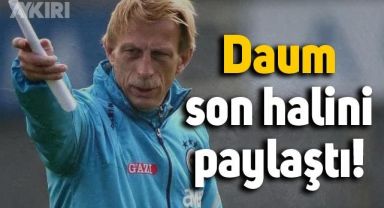 Kanser tedavisi süren Daum'un son hali