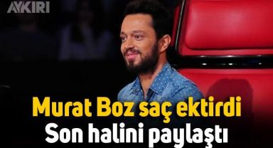 Murat Boz saç ektirdi, son halini paylaştı