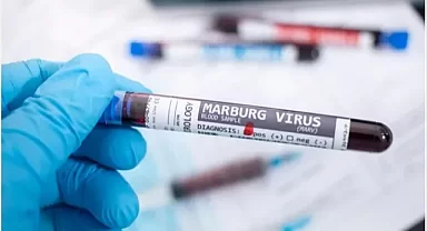 DSÖ'den kritik açıklama: Marburg virüsü yayılmaya devam ediyor